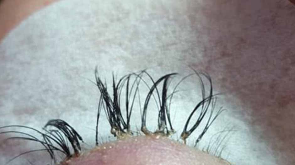 how to regrow eyelashes after eyelash extensions